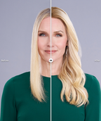 before-after Top Form Lace Human Hair 18" blonde topper