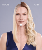 before-after Top Trend Lace HD Wavy 18" blonde topper