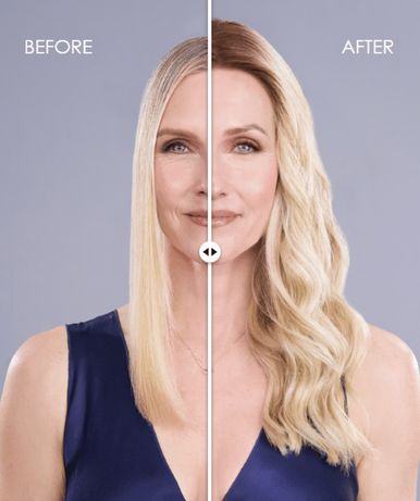 before-after Top Trend Lace HD Wavy 18" blonde topper
