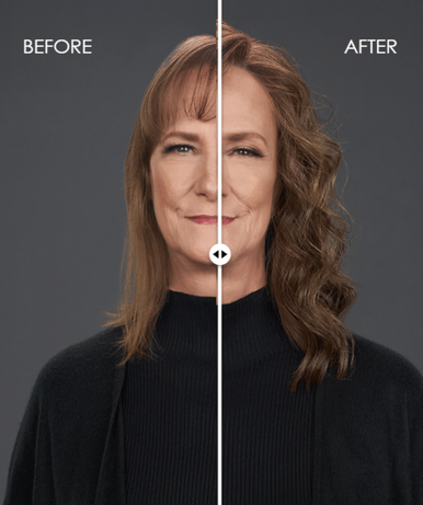 before-after Top Trend Lace HD Wavy 14" brunette topper alt-slider