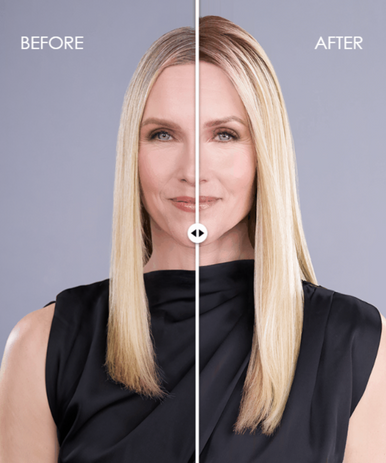 before-after Top Trend Lace HD Straight 18" blonde topper